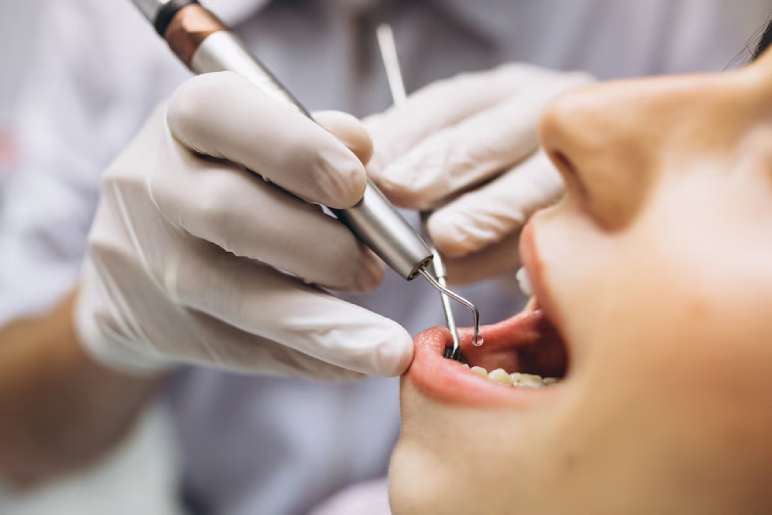 Estimated Cost of Root Canal Treatment in Kolkata