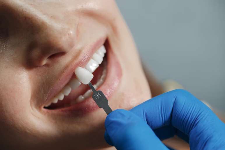 Understanding Dental Implants